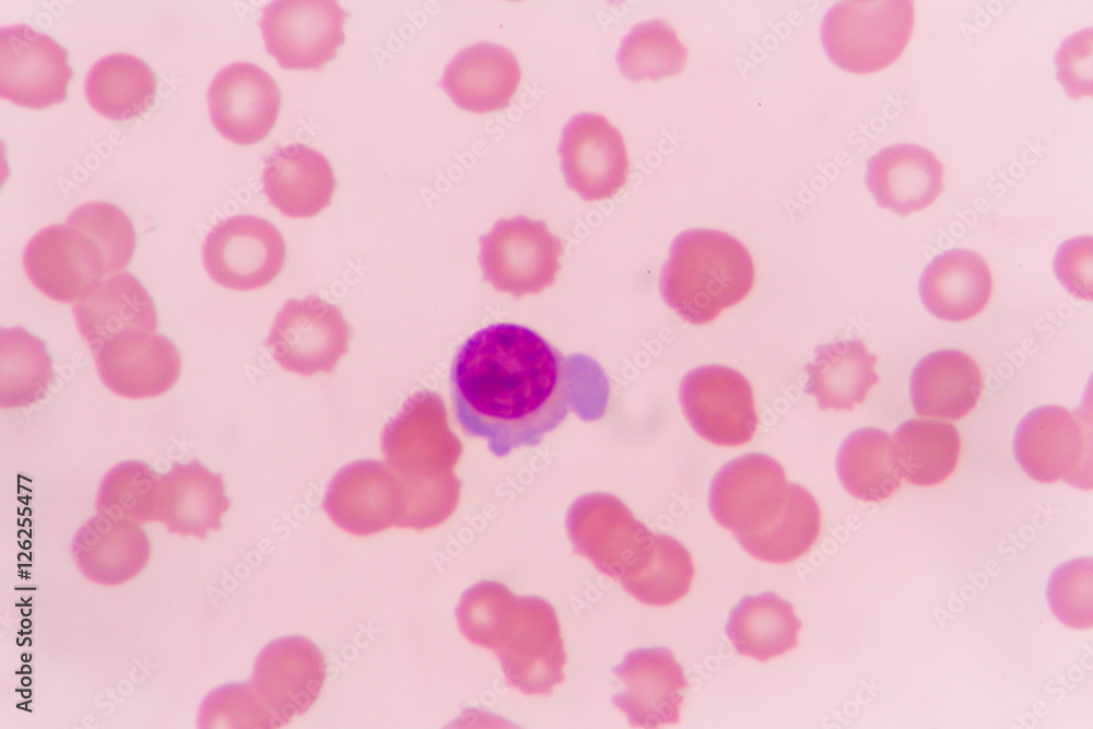 slide blood smear show plasma cell for complete blood count slide blood smear show plasma cell for complete blood count