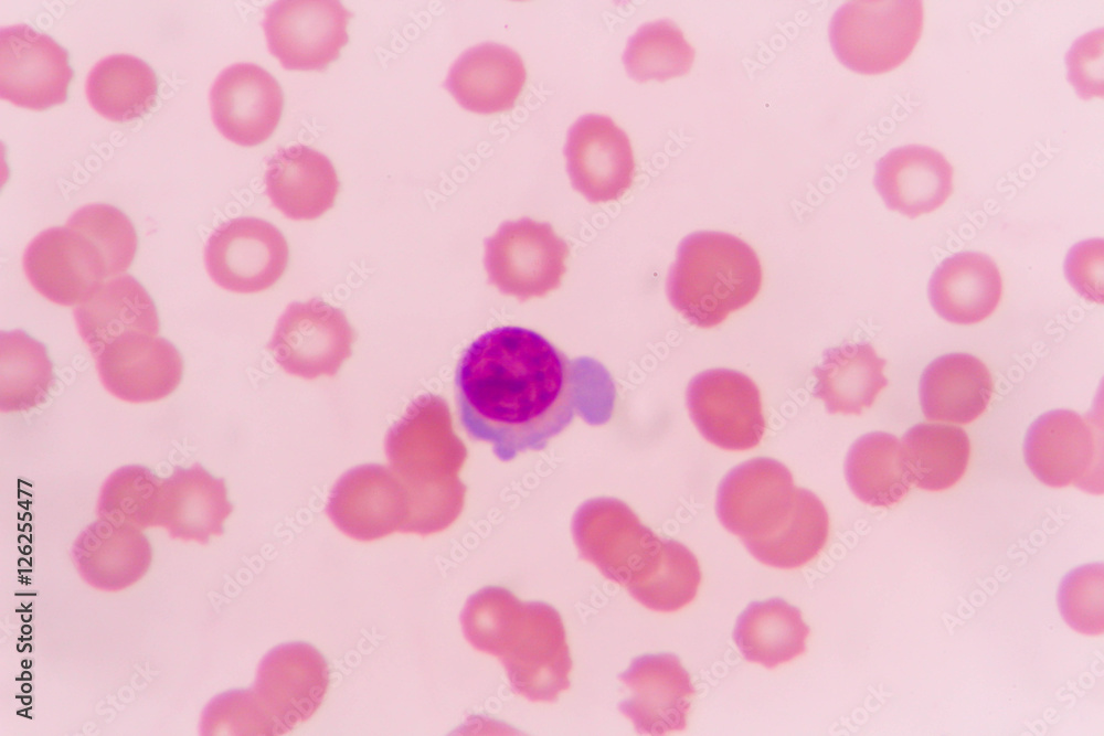 slide blood smear show plasma cell for complete blood count