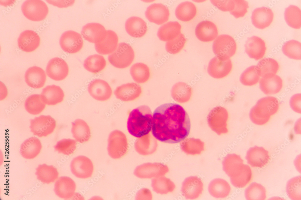slide blood smear show monocyte for complete blood count