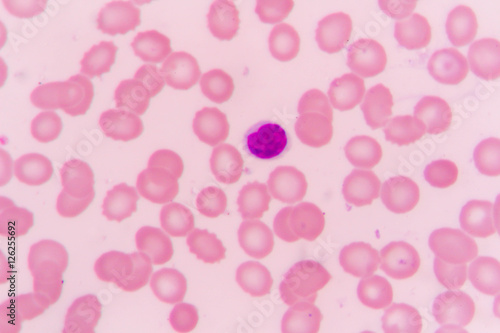 slide blood smear show lymphocyte for complete blood count