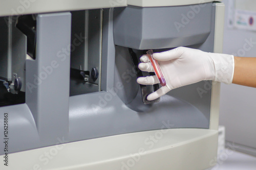 blood flow the tube into  hematology  analyzer