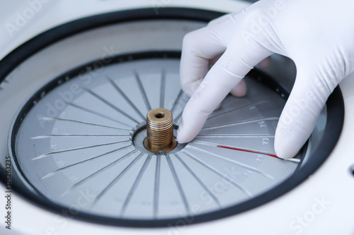 blood sample for hematocrit testing