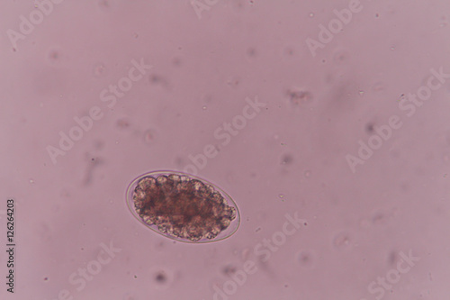 Hookworm egg under light microscopy