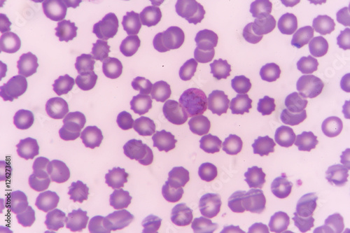 plasmodium malariae trophozoite (band form) photo
