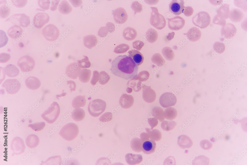 in slide blood smear show Nucleated red cell for complete blood count in slide blood smear show Nucleated red cell for complete blood count