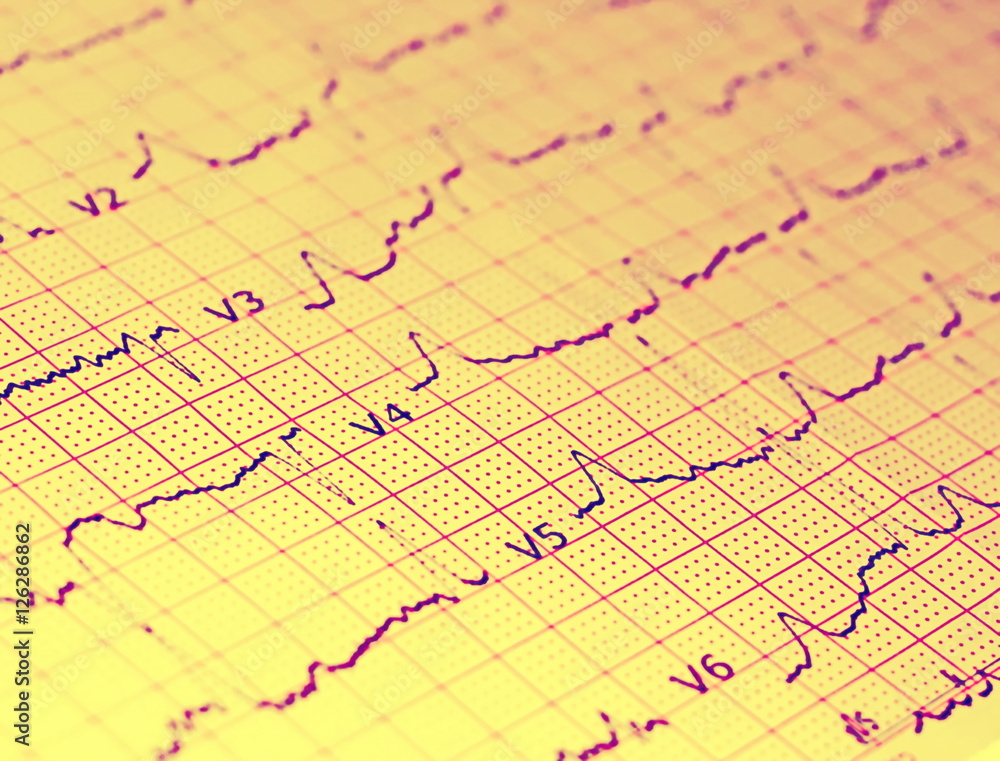 Ecg graph, electrocardiogram background Ecg graph, electrocardiogram background