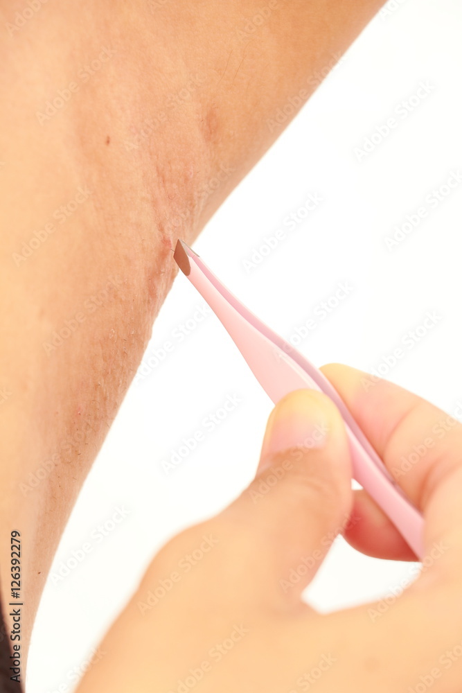 Plucking armpit hair deals