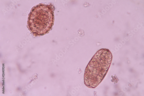 Paragonimus westermani and  Ascaris lumbricoides