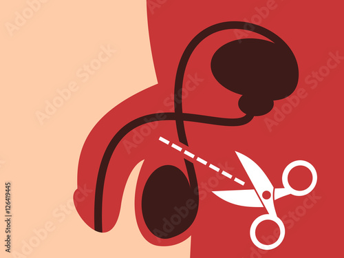 Vasectomy - surgical intervention. Method of birth control and contraception through sterilization of men. End of male reproduction because of lack of sperm in ejaculate. Vector of scissors, genitalia