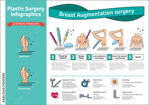 Vector Illustrated set with breast augmentation surgery