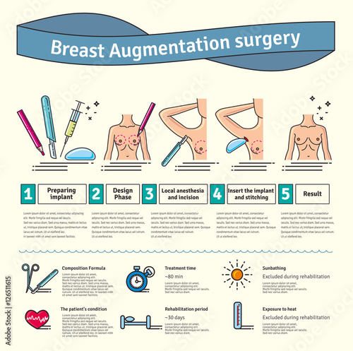 Vector Illustrated set with breast augmentation surgery