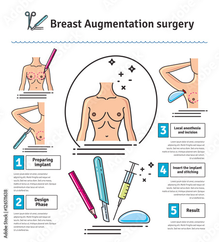 Vector Illustrated set with breast augmentation surgery