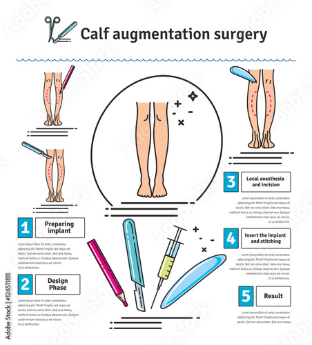 Vector Illustrated set with calf augmentation surgery