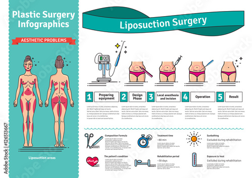Vector Illustrated set with liposuction surgery