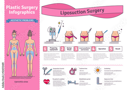 Vector Illustrated set with liposuction surgery