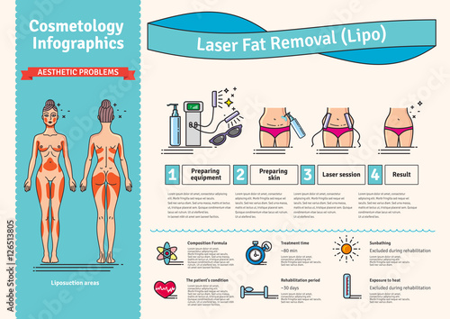 Vector Illustrated set with Laser LIPO Fat Removal