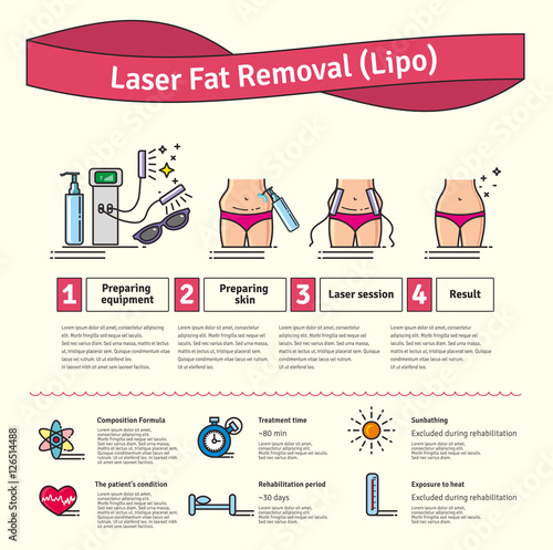 Vector Illustrated set with Laser LIPO Fat Removal