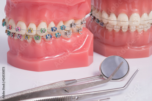 Dentist demonstration teeth model of varities of orthodontic bra photo