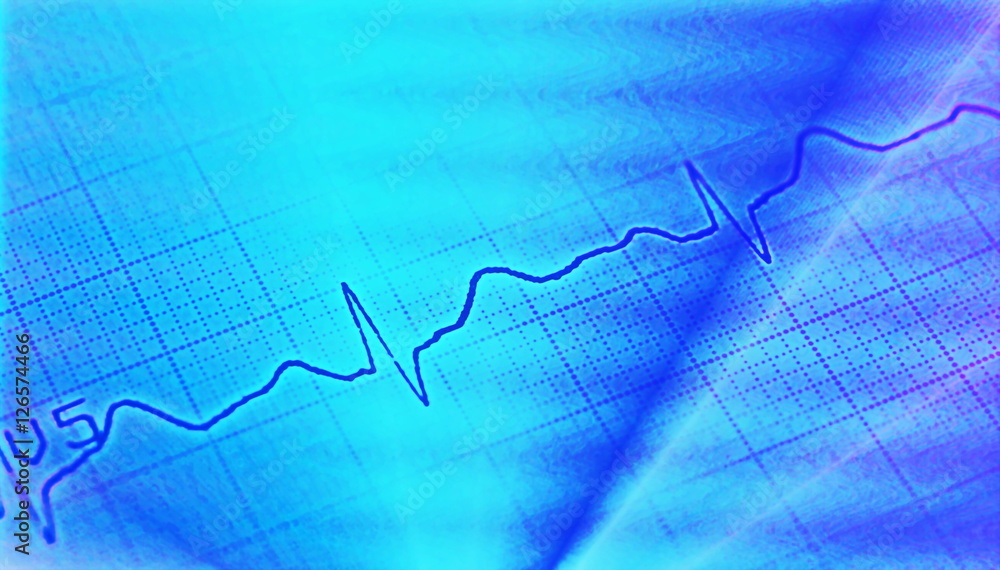 Naklejka premium Ecg graph, electrocardiogram background