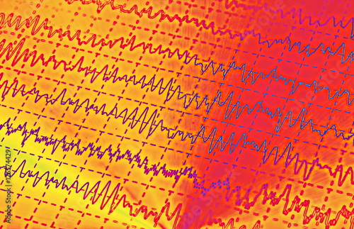Obraz na płótnie brain wave on electroencephalogram, EEG for epilepsy, illustration