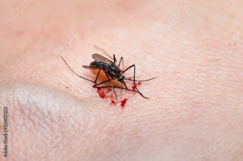 Closeup of killed mosquito with lots of blood. Mosquito feeds on human hand.
