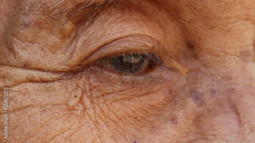 Eye old man
