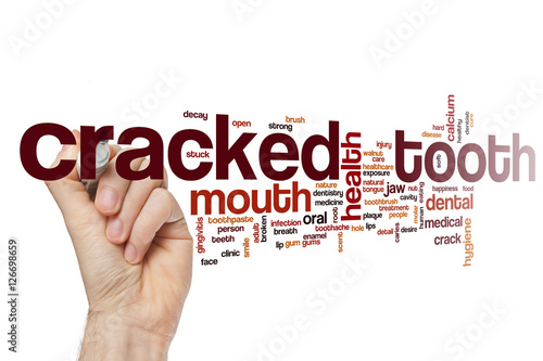 Cracked tooth word cloud