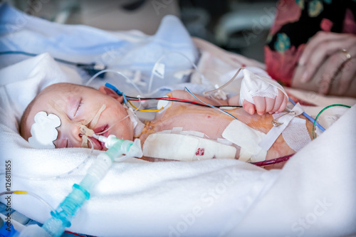 Child in intensive care unit after heart surgery. Shallow depth of field.