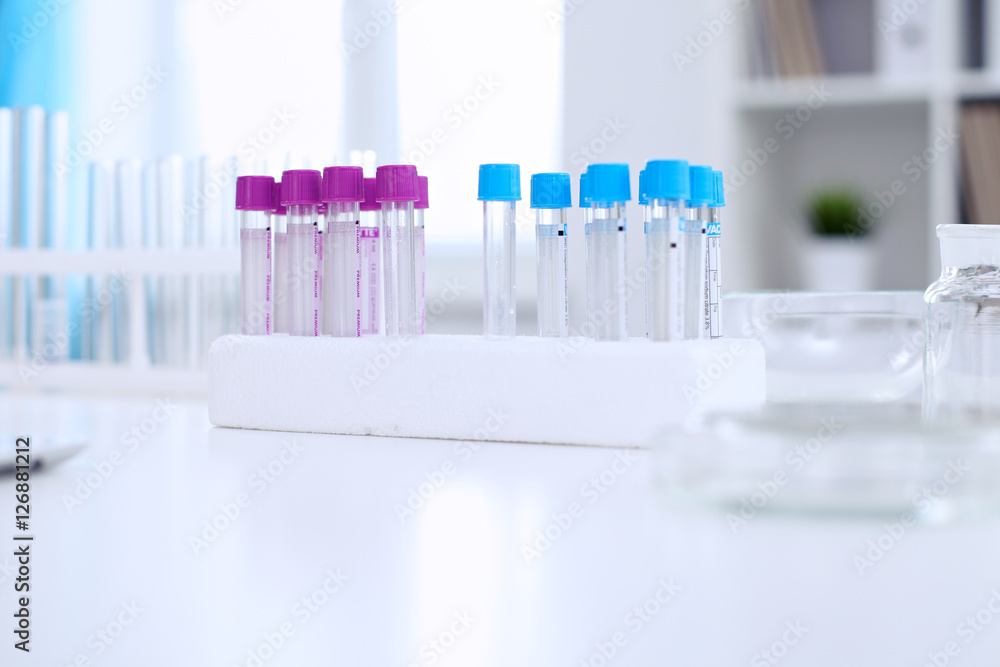 Research laboratory working space. Test tubes and tablet PC are lying at the table. Medical equipment. Blood test Research laboratory working space. Test tubes and tablet PC are lying at the table. Medical equipment. Blood test