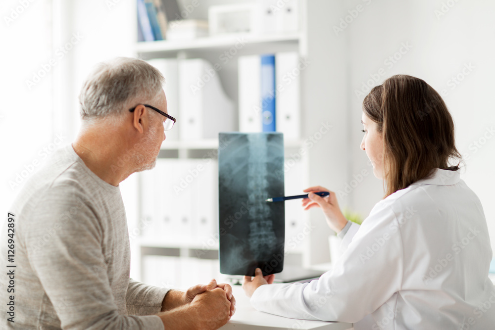 Fototapeta premium doctor with spine x-ray and senior man at hospital