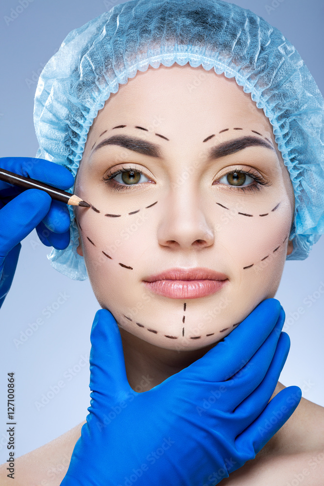 Perforation lines on patient's face Perforation lines on patient's face