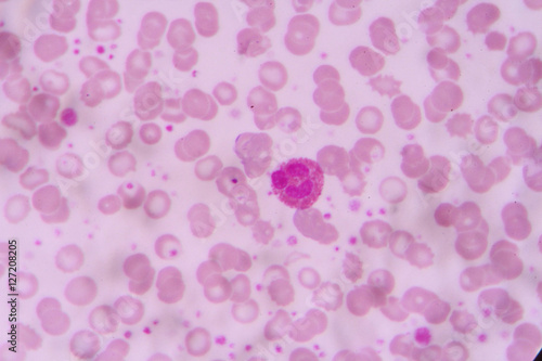 complete blood count