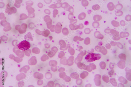 complete blood count