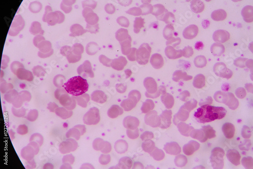 complete blood count