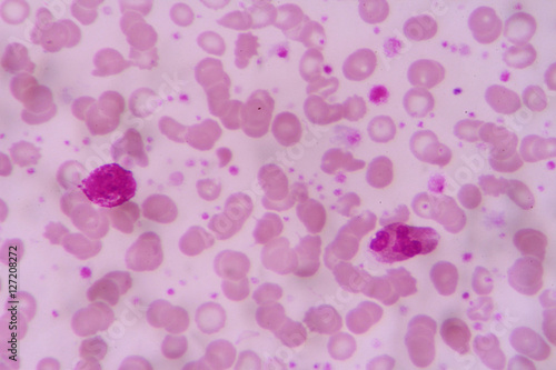 complete blood count