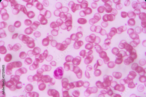 complete blood count