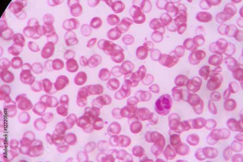 complete blood count