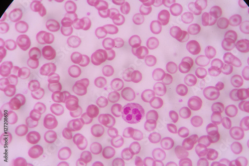 complete blood count