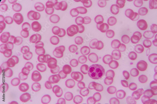 complete blood count