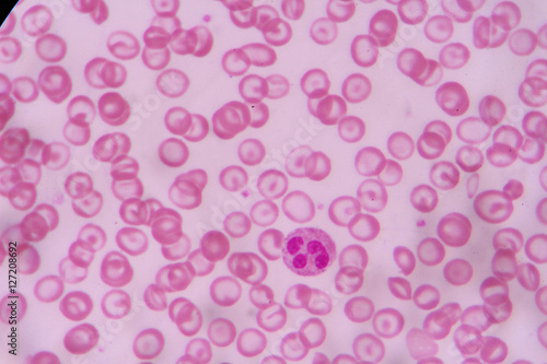 complete blood count