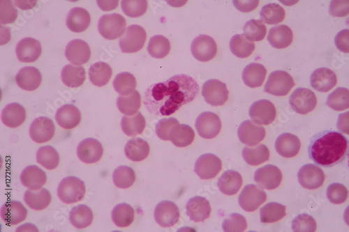 slide blood smear show white blood cell for complete blood count