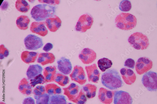 Eosinophil