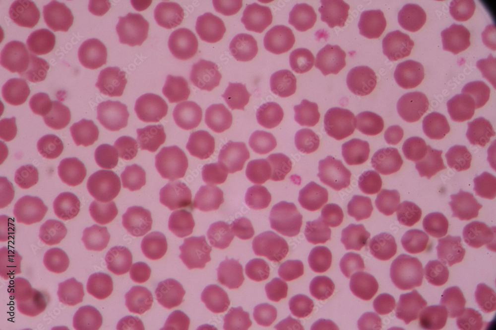 Normal red blood cells.