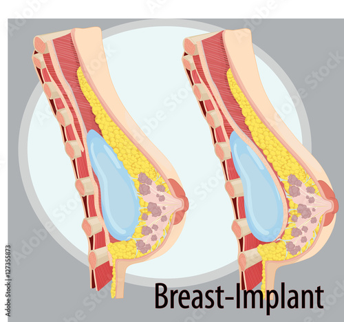 Vector illustration of Breast anatomy