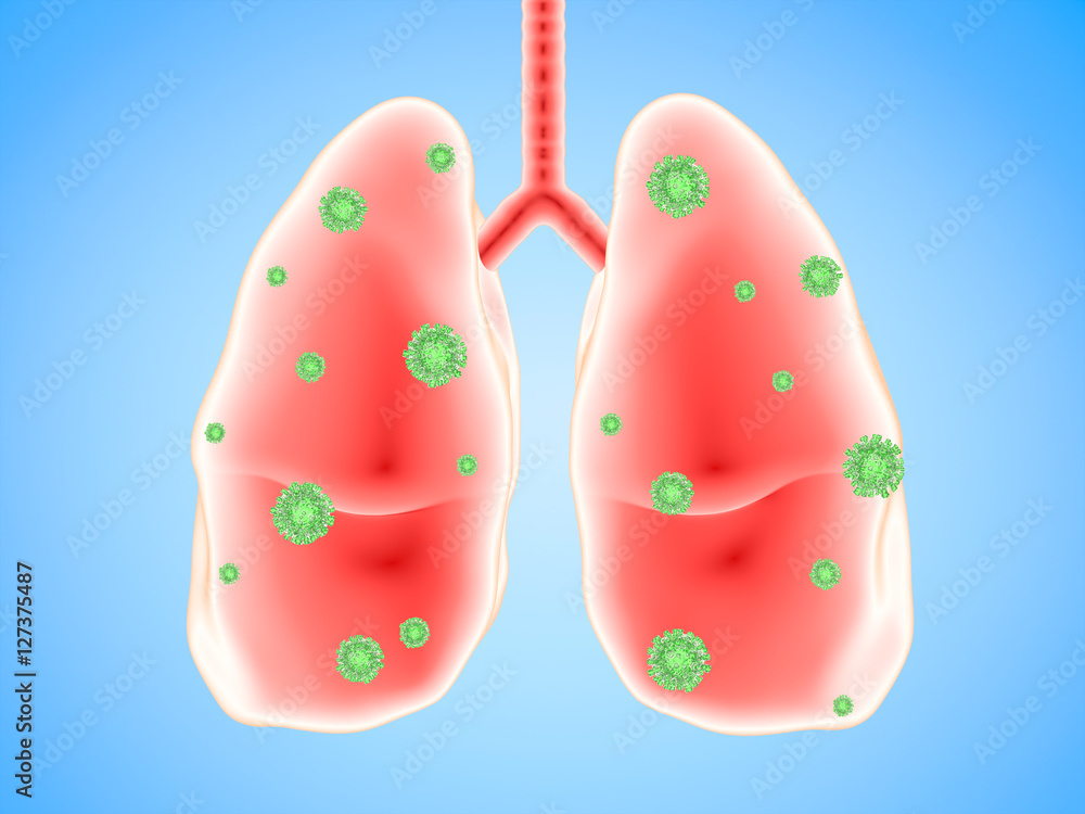 lung disease with bacteria cells lung disease with bacteria cells