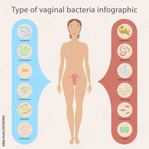 Gynecology Vector illustration. Woman's vaginal flora or microbiota in vagina, Good and Bad Bacteria photo