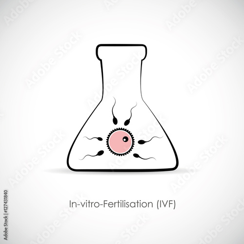 IVF In-vitro-Fertilisation