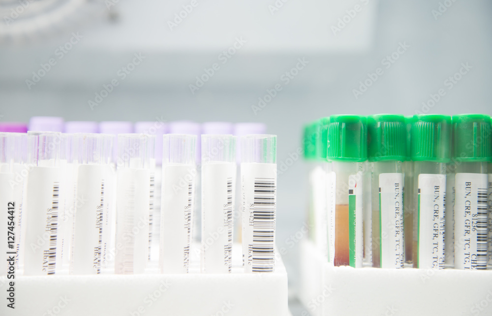 Blood test tube in laboratory.