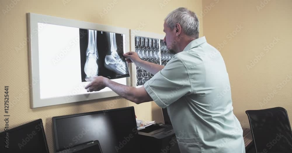 Male doctor reviewing x-ray 4k video. Orthopedist puts xray leg foot scan image on illuminator panel and searching diagnosis Male doctor reviewing x-ray 4k video. Orthopedist puts xray leg foot scan image on illuminator panel and searching diagnosis
