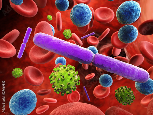blood infection with bacteria and virus cells